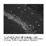 Glucose Transporter GLUT10 Polyclonal Antibody