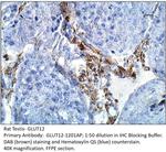 GLUT12 Polyclonal Antibody