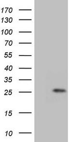 GLYAT Antibody in Western Blot (WB)