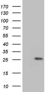GLYAT Antibody in Western Blot (WB)