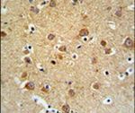 GMFG Antibody in Immunohistochemistry (IHC)