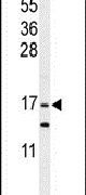 GMFG Antibody in Western Blot (WB)