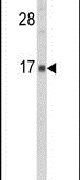 GMFG Antibody in Western Blot (WB)