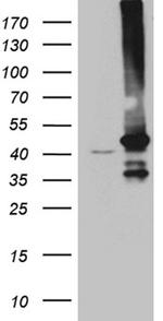 GNA14 Antibody in Western Blot (WB)