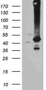 GNA14 Antibody in Western Blot (WB)