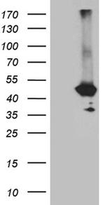 GNA14 Antibody in Western Blot (WB)