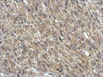 GNAQ Antibody in Immunohistochemistry (IHC)
