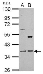 GNAQ Antibody in Western Blot (WB)