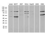 GNAS Antibody in Western Blot (WB)