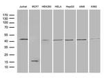 GNAS Antibody in Western Blot (WB)