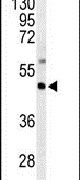 GNAZ Antibody in Western Blot (WB)
