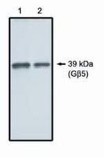 GNB5 Polyclonal Antibody