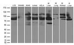 GNE Antibody in Western Blot (WB)