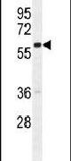 GNL3L Antibody in Western Blot (WB)