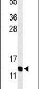 GnRH2 Antibody in Western Blot (WB)