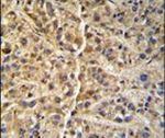 GNS Antibody in Immunohistochemistry (IHC)