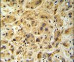 GNS Antibody in Immunohistochemistry (IHC)
