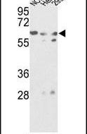 GNS Antibody in Western Blot (WB)