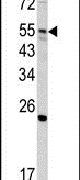 GNS Antibody in Western Blot (WB)