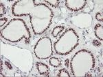 GOLM1 Antibody in Immunohistochemistry (Paraffin) (IHC (P))