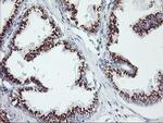 GOLM1 Antibody in Immunohistochemistry (Paraffin) (IHC (P))