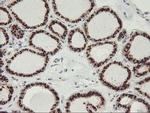 GOLM1 Antibody in Immunohistochemistry (Paraffin) (IHC (P))