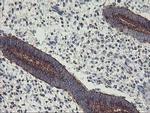 GOLM1 Antibody in Immunohistochemistry (Paraffin) (IHC (P))