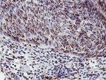 GOLM1 Antibody in Immunohistochemistry (Paraffin) (IHC (P))