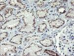 GOLM1 Antibody in Immunohistochemistry (Paraffin) (IHC (P))