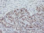 GOLM1 Antibody in Immunohistochemistry (Paraffin) (IHC (P))