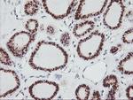 GOLM1 Antibody in Immunohistochemistry (Paraffin) (IHC (P))
