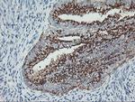 GOLM1 Antibody in Immunohistochemistry (Paraffin) (IHC (P))