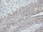 GOLM1 Antibody in Immunohistochemistry (Paraffin) (IHC (P))
