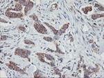 GOLM1 Antibody in Immunohistochemistry (Paraffin) (IHC (P))