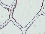 GOLM1 Antibody in Immunohistochemistry (Paraffin) (IHC (P))