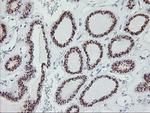 GOLM1 Antibody in Immunohistochemistry (Paraffin) (IHC (P))