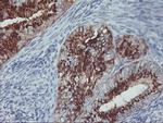 GOLM1 Antibody in Immunohistochemistry (Paraffin) (IHC (P))