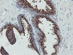 GOLM1 Antibody in Immunohistochemistry (Paraffin) (IHC (P))