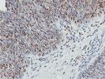 GOLM1 Antibody in Immunohistochemistry (Paraffin) (IHC (P))