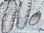 GOLM1 Antibody in Immunohistochemistry (Paraffin) (IHC (P))