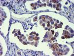 GOLM1 Antibody in Immunohistochemistry (Paraffin) (IHC (P))