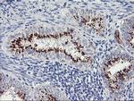 GOLM1 Antibody in Immunohistochemistry (Paraffin) (IHC (P))