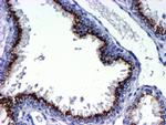 GOLM1 Antibody in Immunohistochemistry (Paraffin) (IHC (P))