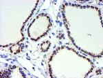 GOLM1 Antibody in Immunohistochemistry (Paraffin) (IHC (P))