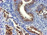 GOLM1 Antibody in Immunohistochemistry (Paraffin) (IHC (P))