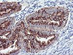 GOLM1 Antibody in Immunohistochemistry (Paraffin) (IHC (P))