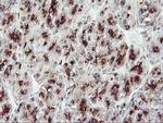 GOLM1 Antibody in Immunohistochemistry (Paraffin) (IHC (P))