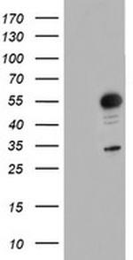 GOLM1 Antibody in Western Blot (WB)