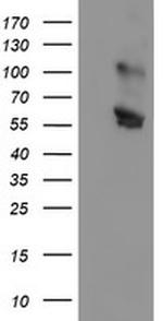 GOLM1 Antibody in Western Blot (WB)