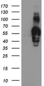 GOLM1 Antibody in Western Blot (WB)